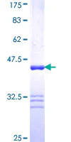 SDS-PAGE - Recombinant Human Filamin C protein (GST tag N-Terminus) (AB158453)