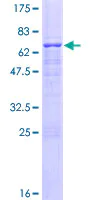 SDS-PAGE - Recombinant Human FIP protein (AB152790)