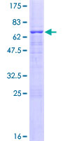SDS-PAGE - Recombinant Human FIP protein (AB152790)