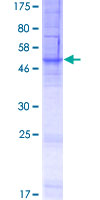 Recombinant Human FITM1 protein