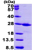 SDS-PAGE - Recombinant human FKBP14 protein (His tag N-Terminus) (AB99328)
