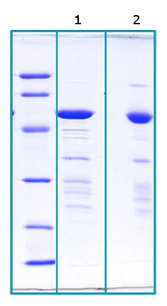 SDS-PAGE - Recombinant Human FKBP51 protein (His tag) (AB206440)