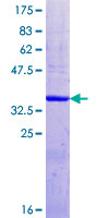 Recombinant Human FKRP protein
