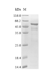 SDS-PAGE - Recombinant Human FKTN Protein (His Tag) (AB314618), expandable thumbnail