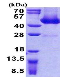 SDS-PAGE - Recombinant Human FLJ11506 protein (His tag N-Terminus) (AB156725)