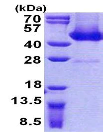 SDS-PAGE - Recombinant Human FLJ11506 protein (His tag N-Terminus) (AB156725)