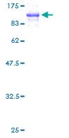 SDS-PAGE - Recombinant Human FLNA protein (AB131760), expandable thumbnail