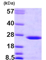 SDS-PAGE - Recombinant Human FLR protein (AB79183)
