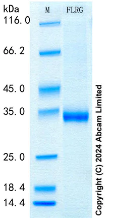 SDS-PAGE - Recombinant Human FLRG Protein Standard (His tag) (AB316656)