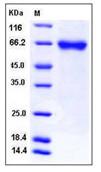 SDS-PAGE - Recombinant Human FLRT1 protein (His tag) (AB276389)