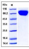 SDS-PAGE - Recombinant Human FLRT3 protein (His tag) (AB276364)