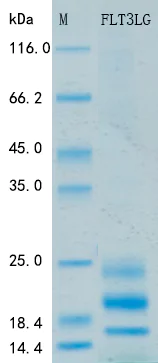 SDS-PAGE - Recombinant Human Flt-3 ligand Protein Standard (His tag) (AB316412)