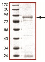 Recombinant human Flt4 protein