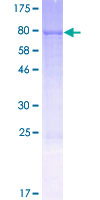 SDS-PAGE - Recombinant Human FMO3 protein (AB152391)