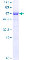 Recombinant Human FMRP protein
