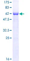 SDS-PAGE - Recombinant Human FMRP protein (GST tag N-Terminus) (AB132093)