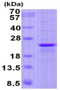 SDS-PAGE - Recombinant Human FOPNL protein (AB131690)