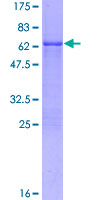 SDS-PAGE - Recombinant Human Fos B protein (AB152396), expandable thumbnail