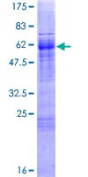SDS-PAGE - Recombinant Human FOXI1 protein (GST tag N-Terminus) (AB132217)