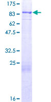SDS-PAGE - Recombinant Human FOXJ2 protein (AB153411), expandable thumbnail