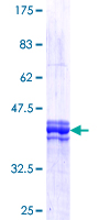 SDS-PAGE - Recombinant Human FOXM1 protein (GST tag N-Terminus) (AB158447)