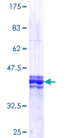 SDS-PAGE - Recombinant Human FOXM1 protein (GST tag N-Terminus) (AB158447)