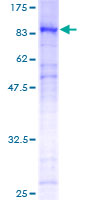 SDS-PAGE - Recombinant Human FOXN3 protein (AB158108), expandable thumbnail