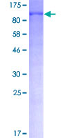 SDS-PAGE - Recombinant Human FOXO3A protein (AB114191)