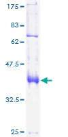 SDS-PAGE - Recombinant Human FOXP1 protein (GST tag N-Terminus) (AB132166)