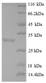 SDS-PAGE - Recombinant Human FOXP3 protein (His tag) (AB226445)