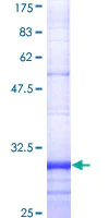 SDS-PAGE - Recombinant Human FPRL1/RFP protein (AB114357)