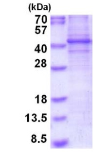 SDS-PAGE - Recombinant Human FRA2 protein (denatured) (AB202143), expandable thumbnail