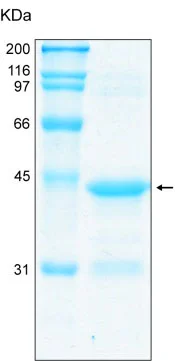 SDS-PAGE - Recombinant Human Fragilis protein (AB92921)