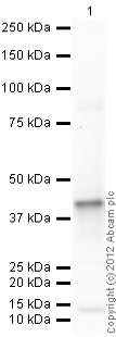 Western blot - Recombinant Human Fragilis protein (6x His + GST) (AB92921)