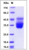 SDS-PAGE - Recombinant Human Fragilis protein (Fc Chimera) (AB276480)