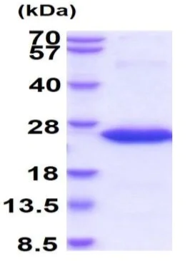 SDS-PAGE - Recombinant Human Frataxin protein (His tag N-Terminus) (AB95502)