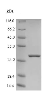 SDS-PAGE - Recombinant Human Frataxin protein (Tagged) (AB238218)