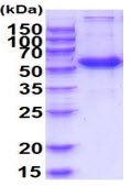 SDS-PAGE - Recombinant Human Frizzled 4 protein (Fc Chimera His Tag) (AB223098), expandable thumbnail