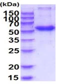 SDS-PAGE - Recombinant Human Frizzled 4 protein (Fc tag C-Terminus + His tag C-Terminus) (AB223098)