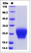 SDS-PAGE - Recombinant Human Frizzled 6 protein (His tag) (AB276698)