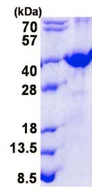 SDS-PAGE - Recombinant Human FRZB protein (denatured) (AB139224), expandable thumbnail