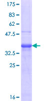 SDS-PAGE - Recombinant Human FSH beta protein (GST tag N-Terminus) (AB158468)