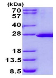 SDS-PAGE - Recombinant Human FTSJ2 protein (His tag N-Terminus) (AB131684)
