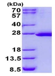 SDS-PAGE - Recombinant Human FTSJ2 protein (His tag N-Terminus) (AB131684)