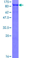 SDS-PAGE - Recombinant Human FUBP1/FBP protein (AB152933), expandable thumbnail