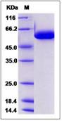 SDS-PAGE - Recombinant Human FUCA1 protein (His tag) (AB276597)