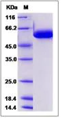 SDS-PAGE - Recombinant Human FUCA1 protein (His tag) (AB276597)