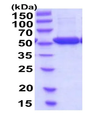 SDS-PAGE - Recombinant Human FUCA1 protein (His tag C-Terminus) (AB207120)