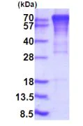 SDS-PAGE - Recombinant Human Furin protein (denatured) (His tag N-Terminus) (AB203526)