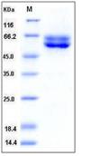 SDS-PAGE - Recombinant Human FUT10 protein (His tag) (AB276382)